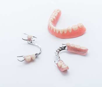 Metal-free partial dentures available in Carlsbad, CA