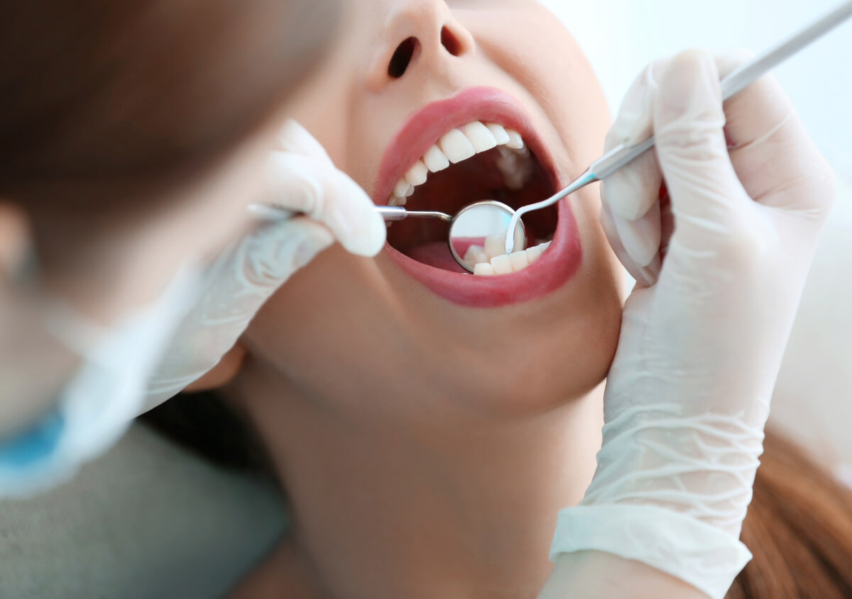 Tooth Colored Composite Dental Fillings in Carlsbad area